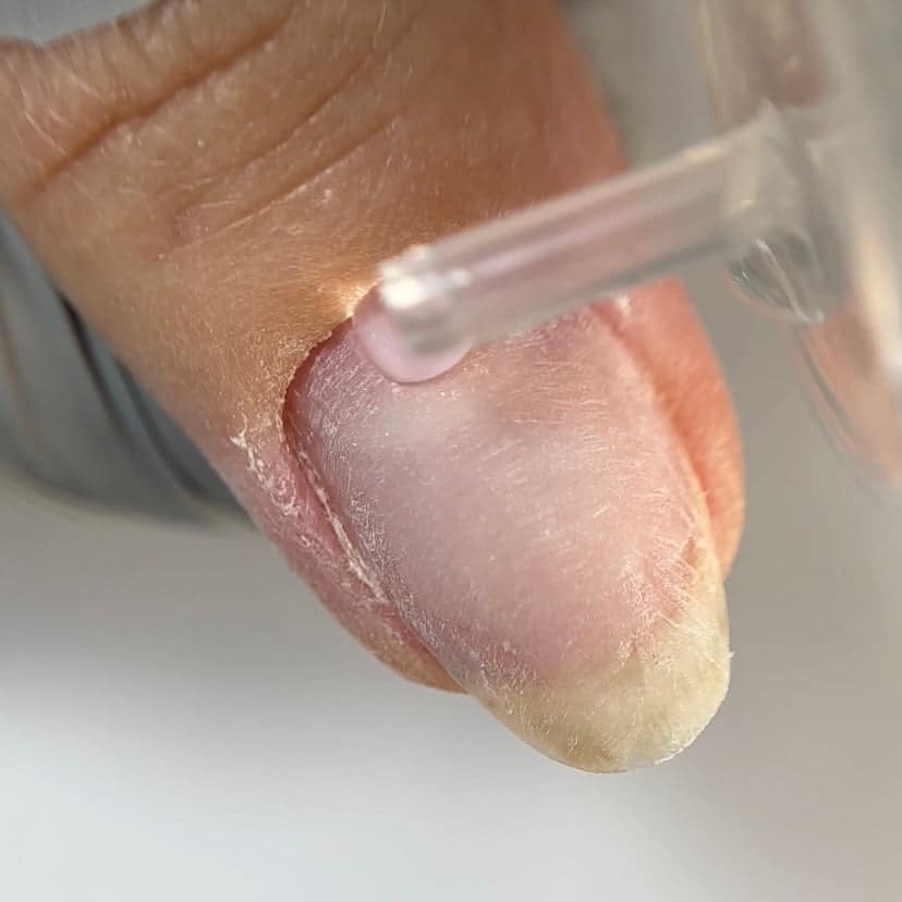 NAILSOFTHEDAY Cuticle Remover - Imagen 5