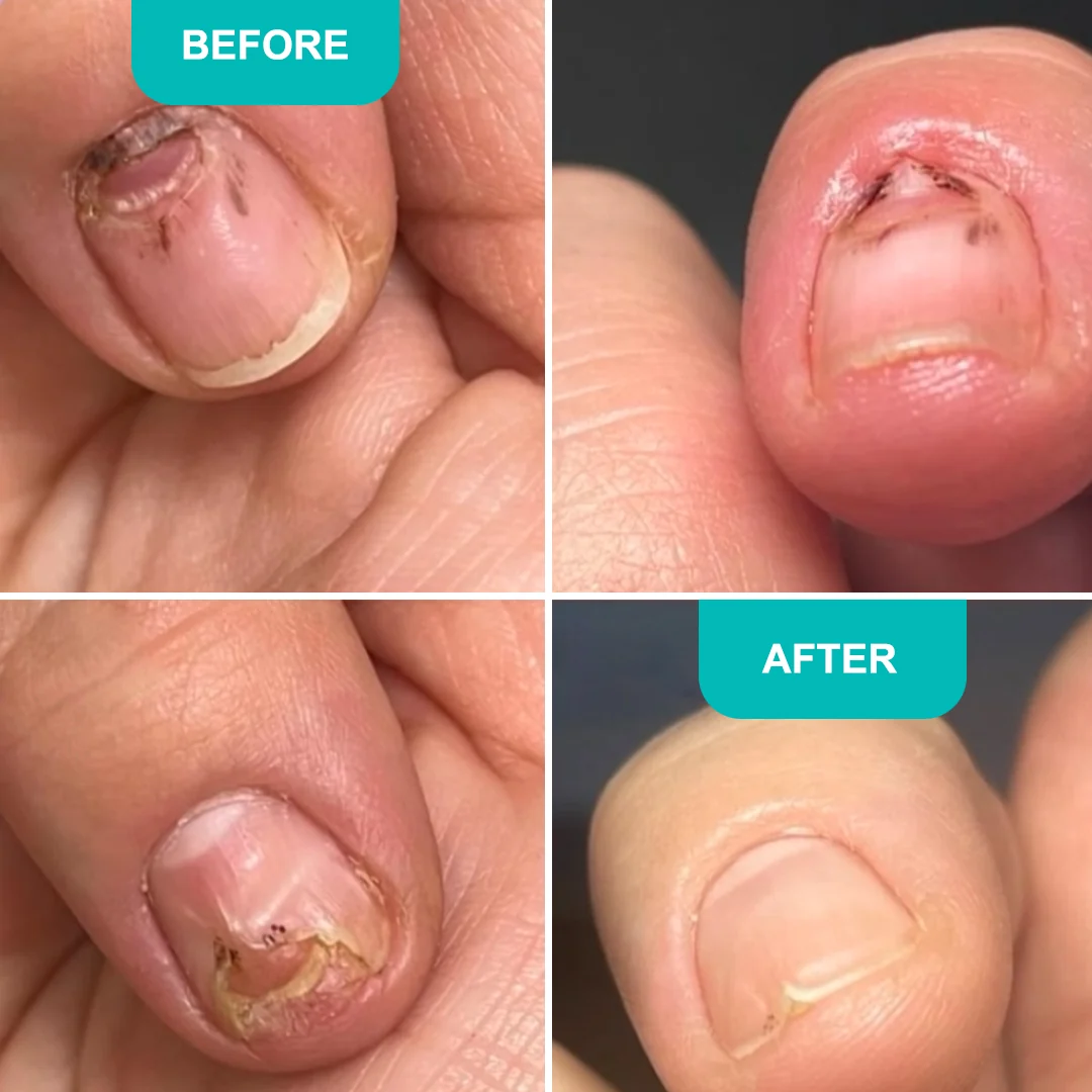 SHELLY Aceite revitalizante para uñas debilitadas · 30 ml - Imagen 2